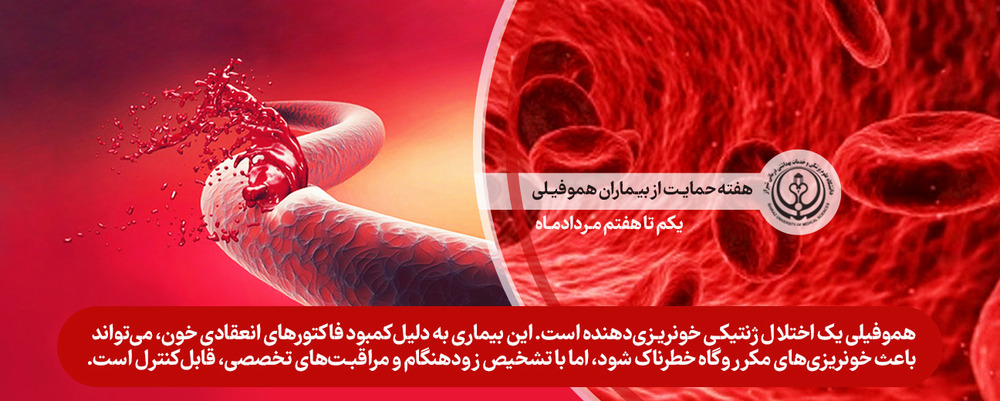 هموفیلی